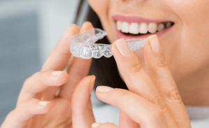 Invisalign Treatment in Mississauga