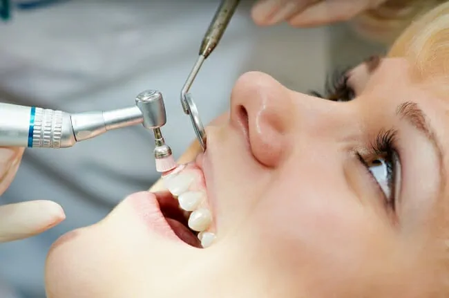 Teeth Cleaning in Mississauga