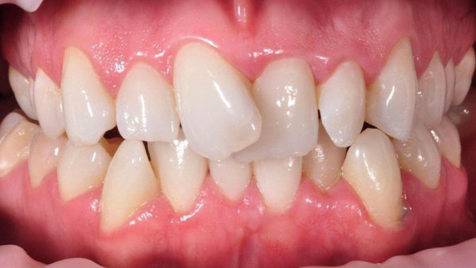 Smile makeover consultation at Eglinton Oak Dental Mississauga