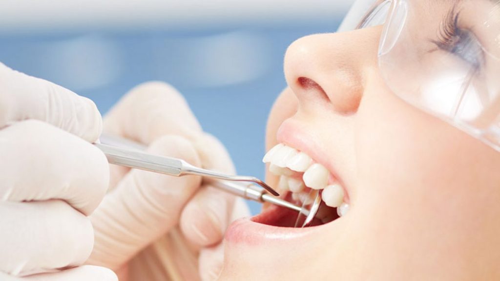 Wisdom tooth removal in Mississauga