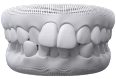 Invisalign Clear Aligner in Mississauga