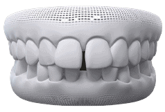 Invisalign Clear Aligner in Mississauga