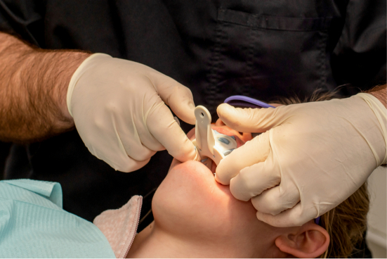 Invisalign vs braces cost comparison Mississauga