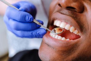 Oral Hygiene – Eglinton Oak Dental, Mississauga
