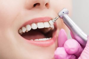 Dentures Mississauga - full and partial denture care at Eglinton Oak Dental