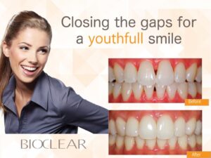 Bioclear Method