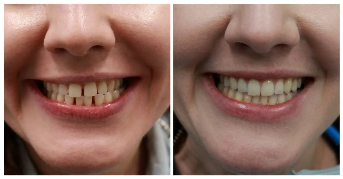 Dental care at Eglinton Oak Dental in Mississauga, ON