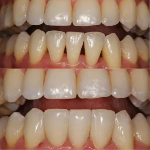 Bioclear Method