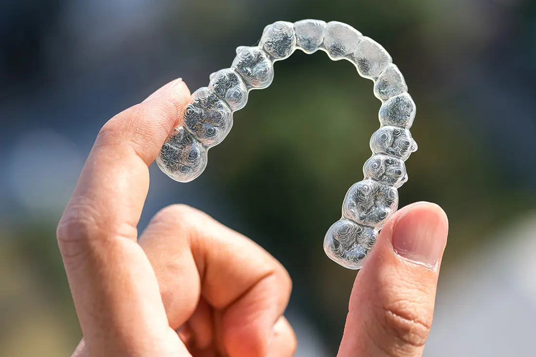 Clear aligner tray held between the fingers - clear aligner treatment at Eglinton Oak Dental, Mississauga