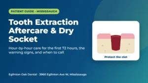Tooth extraction aftercare and dry socket guide from Eglinton Oak Dental, Mississauga