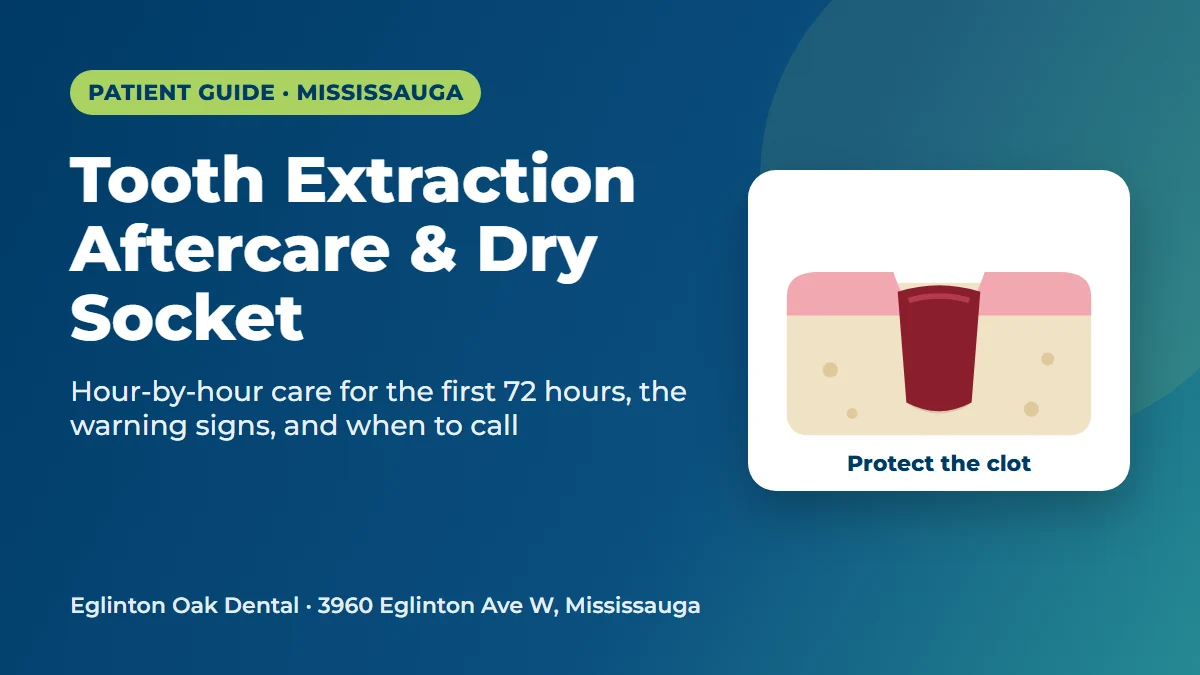 Tooth extraction aftercare and dry socket guide from Eglinton Oak Dental, Mississauga